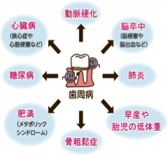 歯周病は万病の元