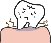 歯ぐきやせる